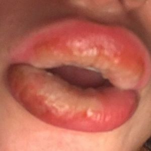 THIS IS WHAT CAN HAPPEN FROM USING FAKE KYLIE’S